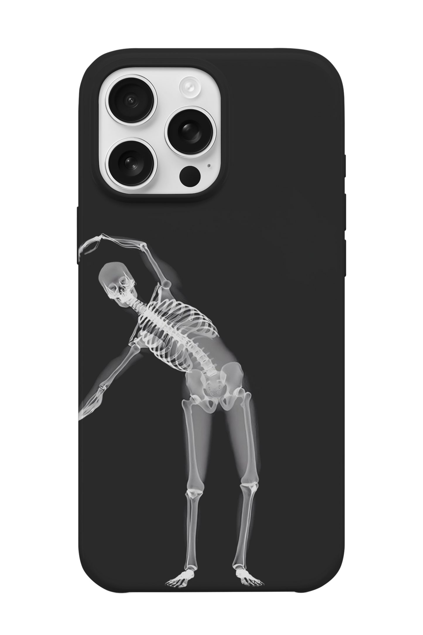 Girl Skeleton Telefon Kılıfı